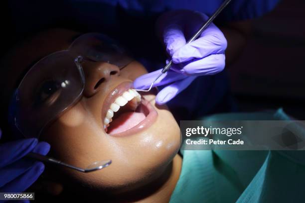 close up of dentistry procedure - plaque bacteria fotografías e imágenes de stock