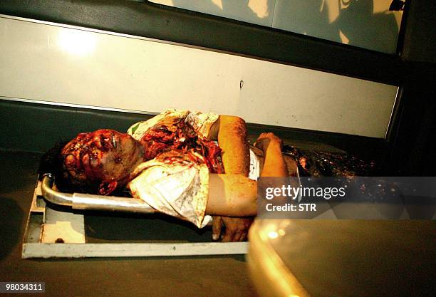 An unidentified injured man lies on a stretcher in an ambulance after a bomb blast in Kuta, on the island of Bali, 01 October 2005. At least 23...