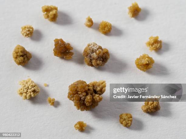 784 Kidney Stone Stock Photos, High-Res Pictures, and Images - Getty Images