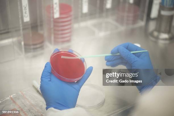 Gi Lab Photos and Premium High Res Pictures - Getty Images