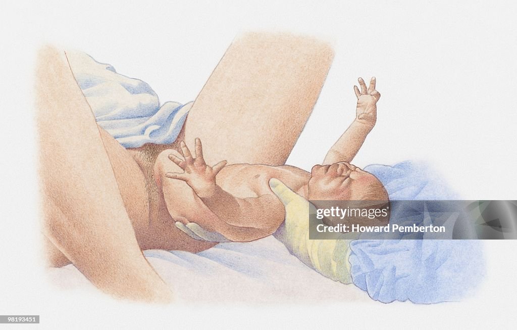 Baby emerging and being held in midwife's hands