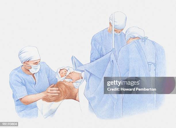 woman holding newborn baby after ceasarian birth, surrounded by doctors - baby lying on back stock illustrations