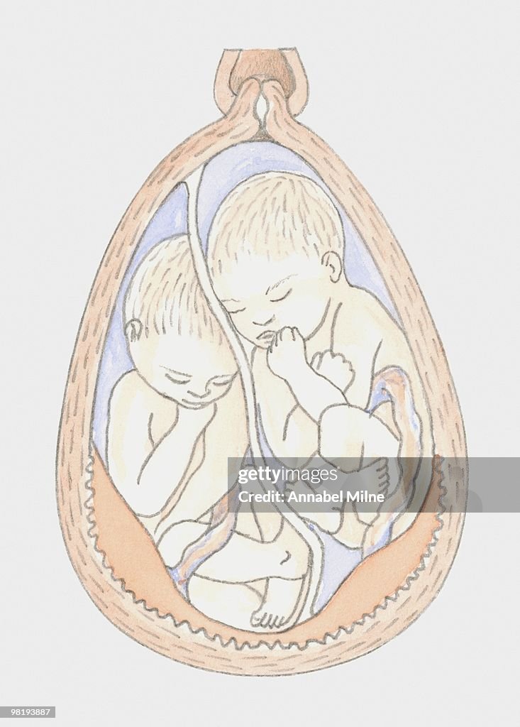 Identical twins in the womb