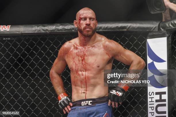 Mixed martial arts fighter Donald 'Cowboy' Cerrone of the US looks on after a fight against Leon 'Rocky' Edwards of Britain during the UFC Fight...