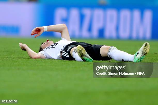 Sebastian Rudy of Germany lies o the pitch injured during the 2018 FIFA World Cup Russia group F match between Germany and Sweden at Fisht Stadium on...