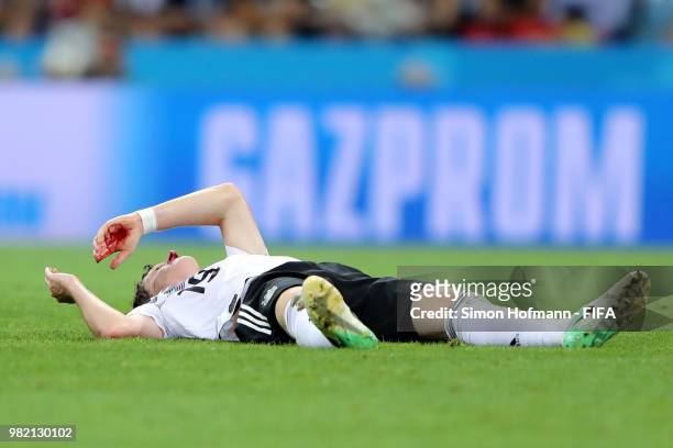 Sebastian Rudy of Germany lies o the pitch injured during the 2018 FIFA World Cup Russia group F match between Germany and Sweden at Fisht Stadium on...