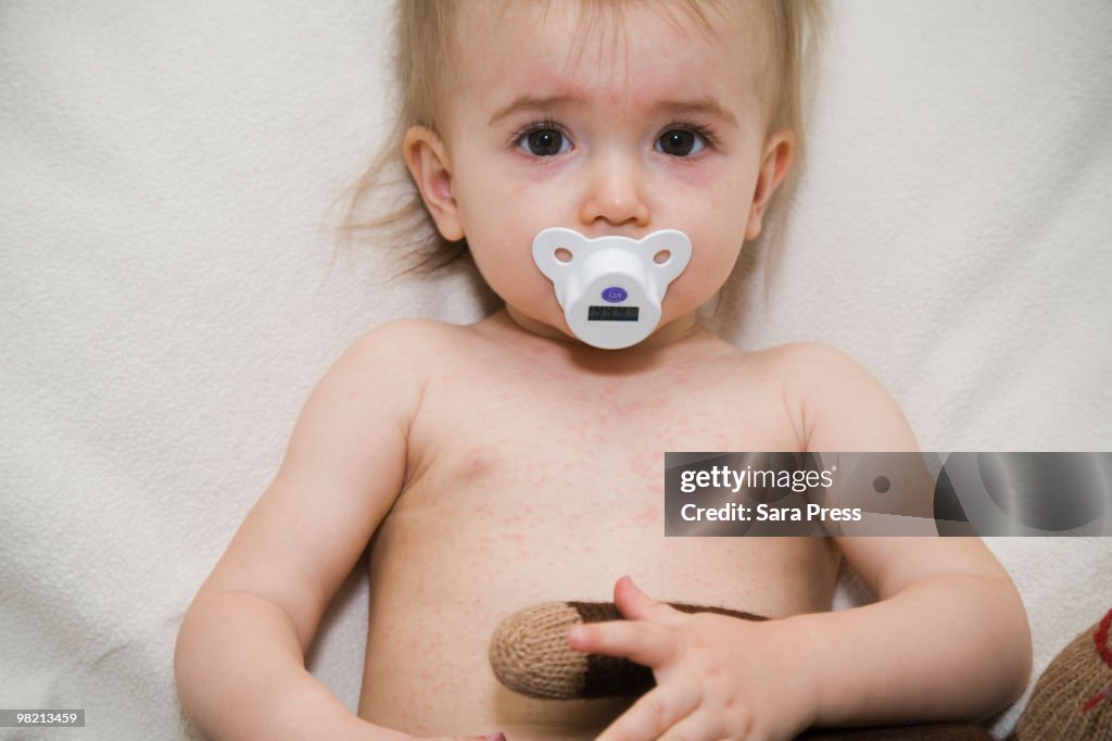 Pretty Roses Rash Mild Roseola Rash