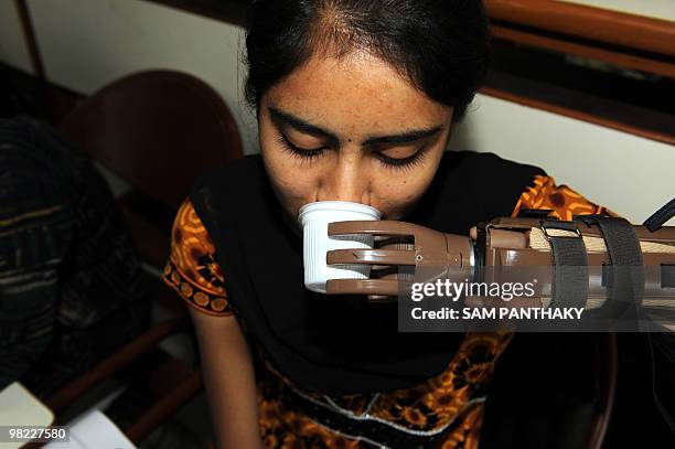 Physically-challenged 19-year old Sonal Suthar drinks water from a cup held using her artificial limb at the Blind People's Association in Ahmedabad...