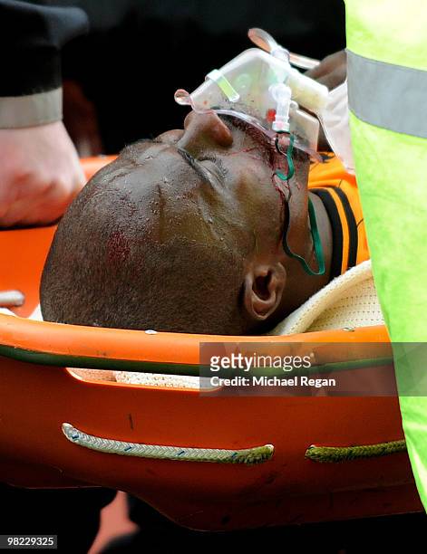 George Boateng of Hull is stretchered off with an oxygen mask following a kick in the head during the Barclays Premier League match between Stoke...