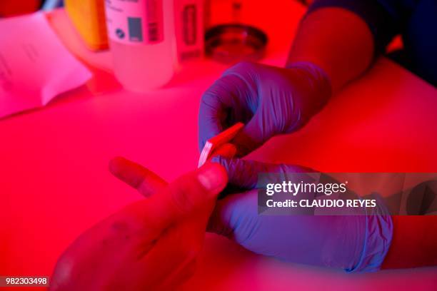 Man undergoes a rapid VIH test during the Gay Pride Parade in Santiago on June 23, 2018. - The initiative aims to encourage prevention, as there is...