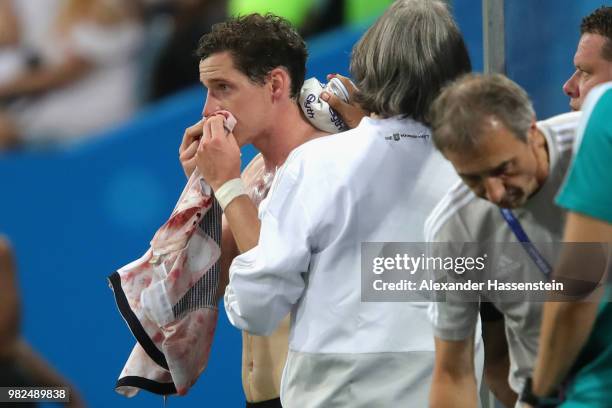 Sebastian Rudy of Germanyreceives treatment following an injury during the 2018 FIFA World Cup Russia group F match between Germany and Sweden at...