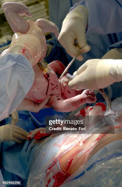 cutting of the umbilico cord - umbilical cord stock-fotos und bilder