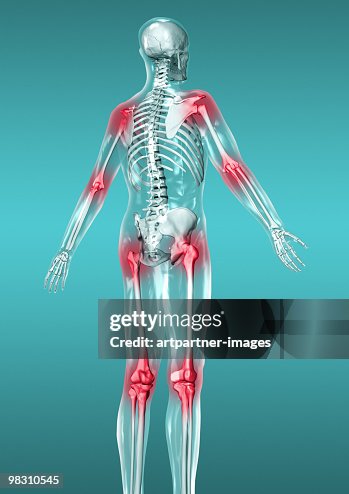 Skeleton with Red Joints for Pain / Inflamation Skeleton with Red Joints for Pain / Inflamation
