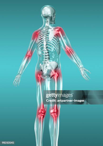 skeleton with red joints for pain / inflamation - inflammation stock illustrations