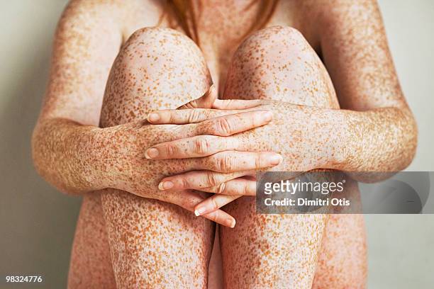 freckled girls hands, arms and legs, close up - parte del cuerpo humano fotografías e imágenes de stock