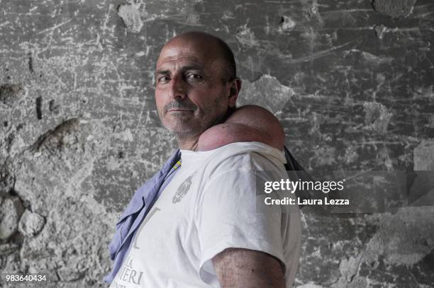 Man poses for a photo just after the annual Festa dei Gigli with his shoulder strain called 'patana' or 'pataniello' caused by having carried a...