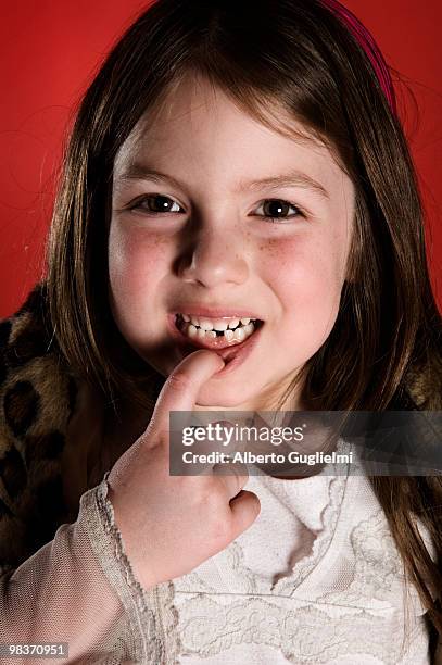 young girl with lost tooth.  - alberto guglielmi imagens e fotografias de stock