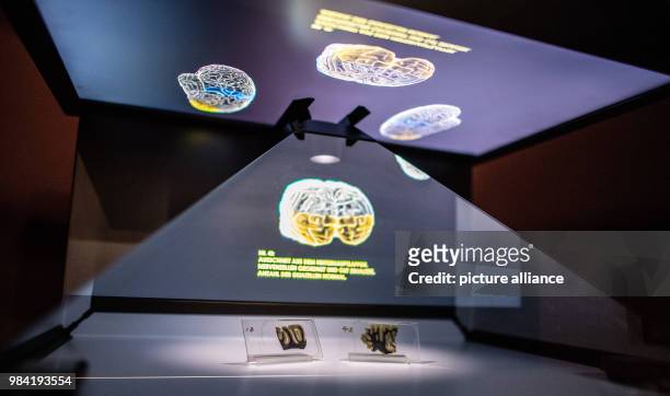 June 2018, Muenster, Germany: Two microscopic brain tissue pieces of Albert Einstein can be seen at the exhibition opening of "Das Gehirn -...