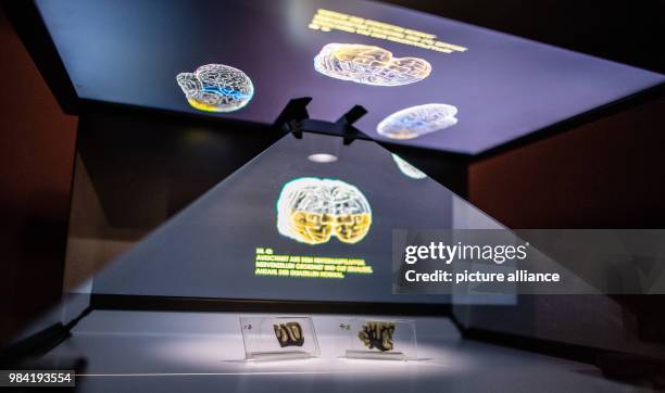 June 2018, Muenster, Germany: Two microscopic brain tissue pieces of Albert Einstein can be seen at the exhibition opening of "Das Gehirn -...