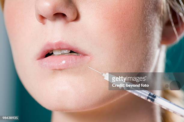 close-up of young woman getting injection in mouth - lip injections stock pictures, royalty-free photos & images