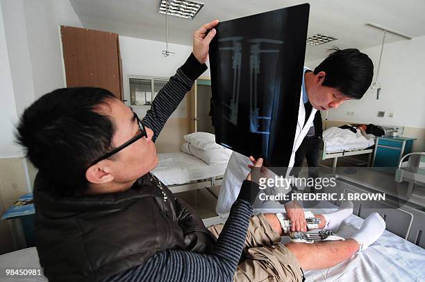 Health-China-lifestyle,FEATURE" by Pascal Trouillaud A recently operated on patient looks an an X-Ray of his legs while receiving treatment from...