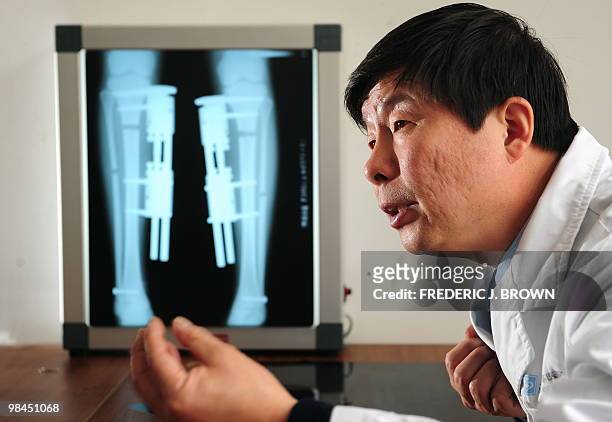 Health-China-lifestyle,FEATURE" by Pascal Trouillaud An X-Ray shows braces on a patients legs as Orthopedic surgeon Bai Helong describes the...