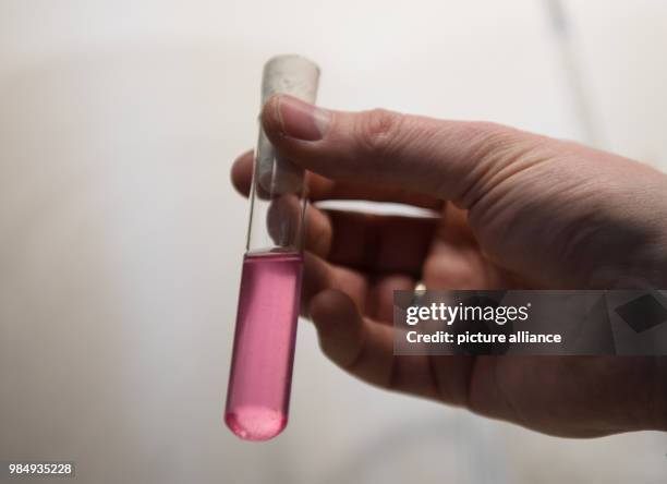 The head of the national reference centre for invasive fungal infections, Oliver Kurzai, holding a sample of a yeast fungus in a test tube with a...