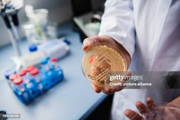 The director of the National Reference Centre for Invasive Fungus Infections, Oliver Kurzai, holding in his hands a petri dish holding the yeast...