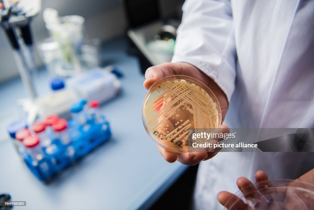 Experts warn of newly-discovered yeast