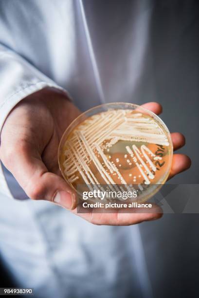 The director of the National Reference Centre for Invasive Fungus Infections, Oliver Kurzai, holding in his hands a petri dish holding the yeast...