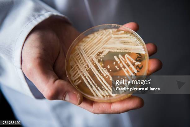 The director of the National Reference Centre for Invasive Fungus Infections, Oliver Kurzai, holding in his hands a petri dish holding the yeast...