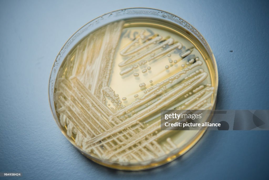 Experts warn of newly-discovered yeast