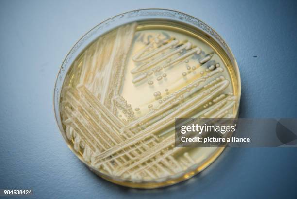 Picture of the yeast candida auris in a petri dish taken in a laboratory of Wuerzburg University in Wuerzburg, Germany, 23 January 2018. There has...