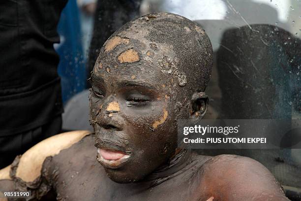 Man rescued from the fuel tankers and trucks on fire at Ibafo, Ogun State on Lagos Ibadan Highway early hours is pictured on April 17, 2010. Two...