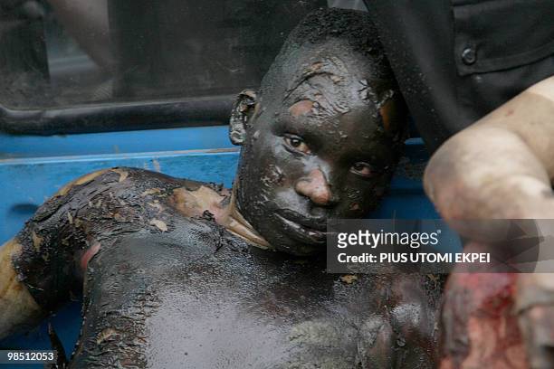 Man rescued from the fuel tankers and trucks on fire at Ibafo, Ogun State on Lagos Ibadan Highway early hours is pictured on April 17, 2010. Two...