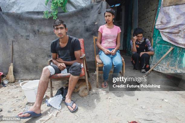 Yosyp Rats who was injured during the attack on a Roma camp near Lviv sits outside a tent in Barkasovo village, Mukachevo district, Zakarpattia...