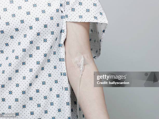 woman wearing hospital gown with intravenous drip. - iv going into an arm 個照片及圖片檔