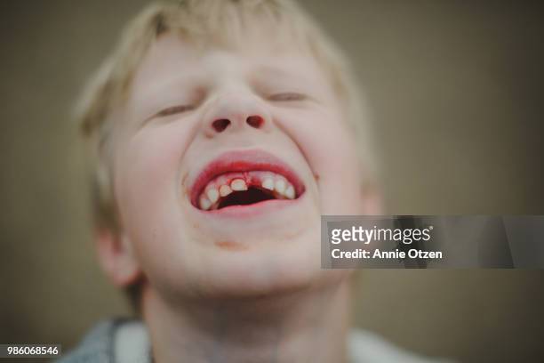 Boy with bleeding tooth