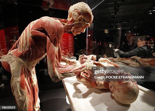 Plastinated heart surgeon sculpture and a plastinated patient sculpture are pictured during the exhibition "Koerperwelten - eine Herzenssache" by...