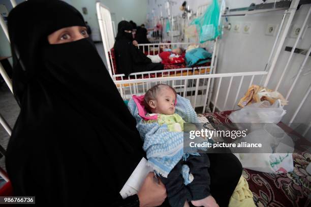 Febuary 2018, Yemen, Sanaa: A mother holding her malnourished child, which is being provided for in the emergency room of a hospital. According to a...