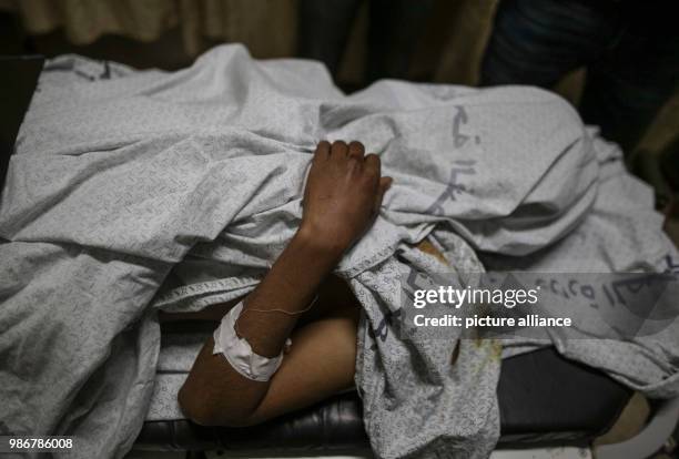 Palestinian youth who got wounded during an Israeli air strike, lays at a hospital in Rafah, southern Gaza Strip, 18 February 2018. Israeli fighter...