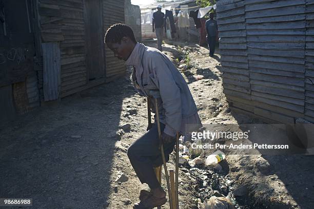 Crippled man walks next to a garbage pile on March 10 in Duncan Village a poor township outside East London, South Africa. This area is one of the...