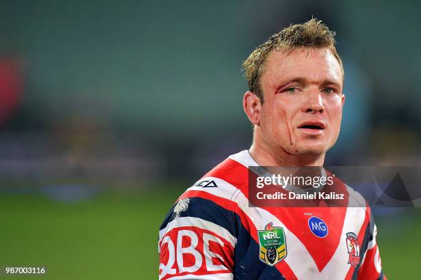 Jake Friend of the Roosters looks on after the round 16 NRL match between the Sydney Roosters and the Melbourne Storm at Adelaide Oval on June 29,...