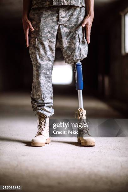 young depressed soldier with amputee leg - injured us army stock pictures, royalty-free photos & images