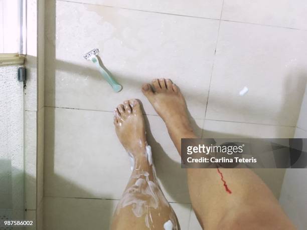 razor cut legs - leg wound fotografías e imágenes de stock