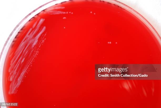Colonial morphology of Gram-negative Yersinia pestis bacteria grown 48 hours on a medium of sheep's blood agar , 2010. Image courtesy Centers for...