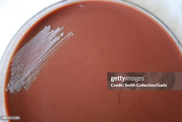 Colonial morphology of Gram-negative Francisella tularensis bacteria grown 24 hours on a medium of cysteine heart infusion agar , 2010. Image...