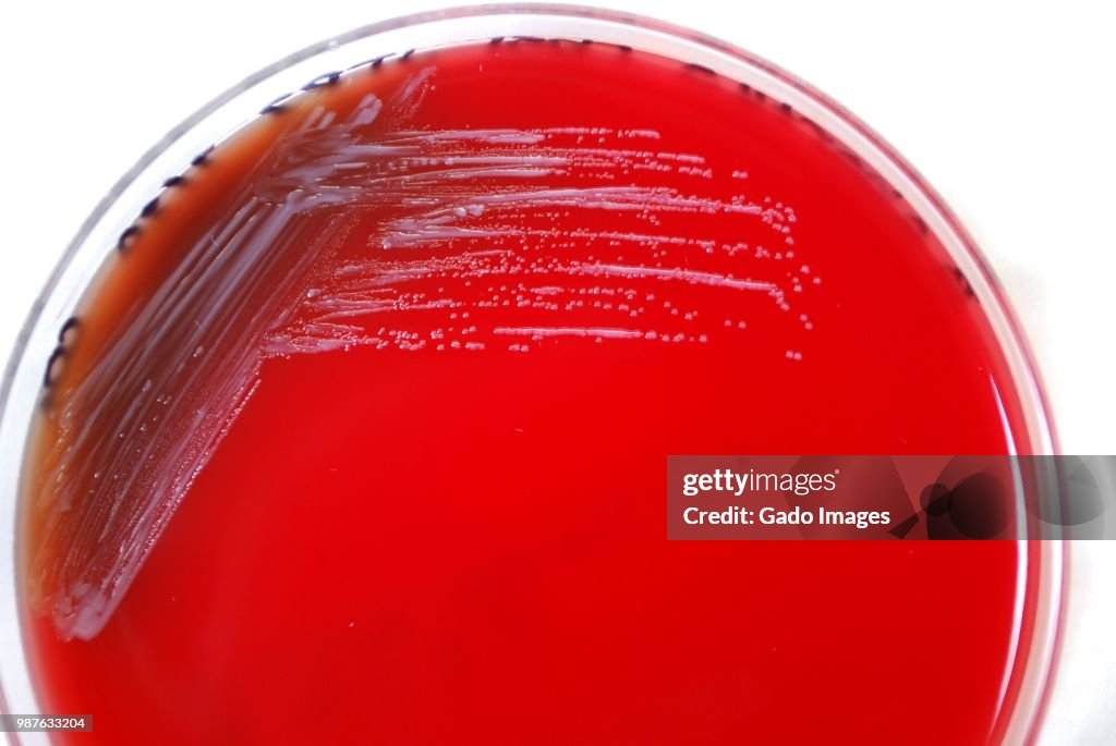 Brucella Abortus Bacteria