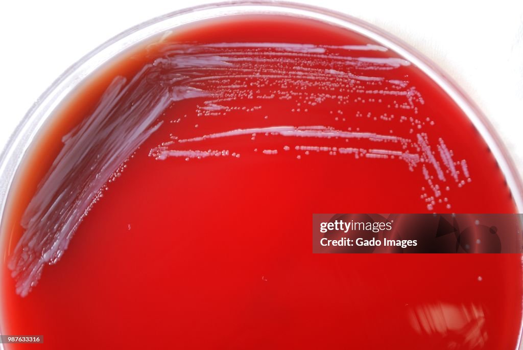 Brucella Abortus Bacteria