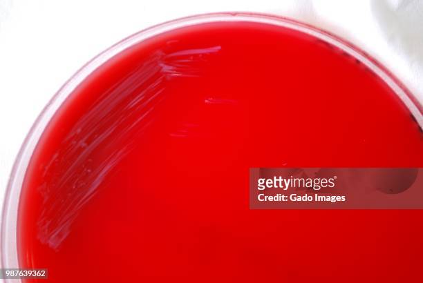 brucella abortus bacteria - abortus stock-fotos und bilder